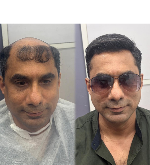 Hair Wigs service at Hercovits Hair Studio